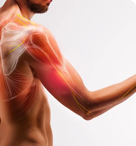 Causas de la tendinitis del bíceps en el hombro