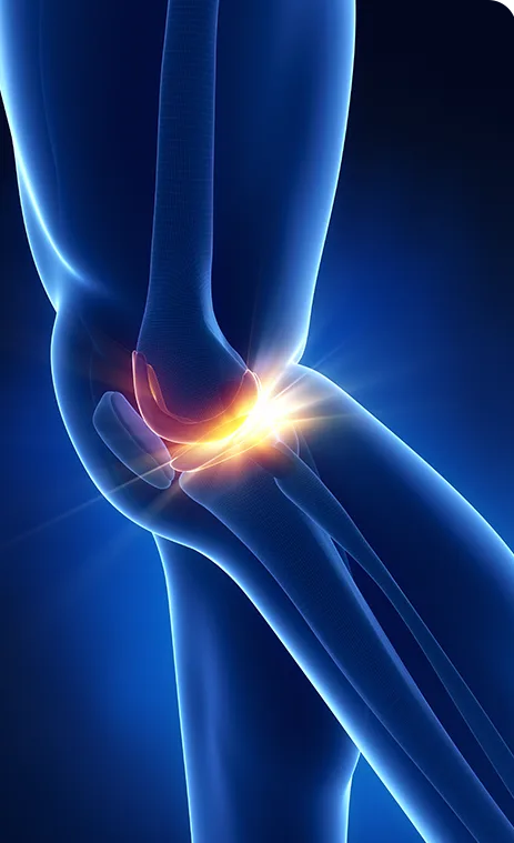 Prevención de la rodilla condromalacia mediante ejercicio y buena condición física