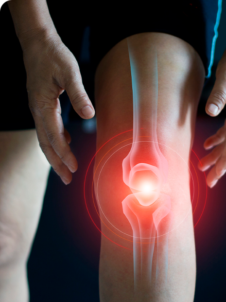 Esguince de rodilla - dolor
